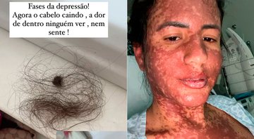 Carol Aguiar lamentou queda de cabelo após doença de pele - Foto: Reprodução/ Instagram@caroline.luzaguiar