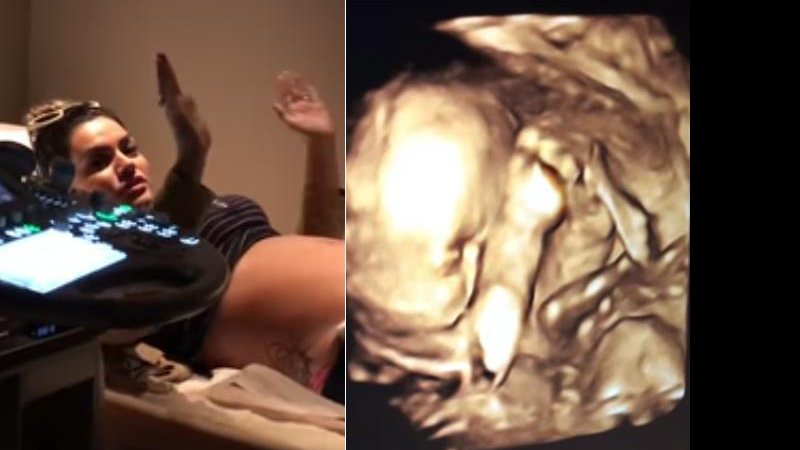 Kelly Key mostra o rostinho do filho Artur em ultrassonografia - Foto: Reprodução