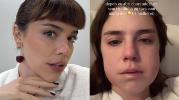 Alice Wegmann mostrou rosto inchado após retirar dentes do siso