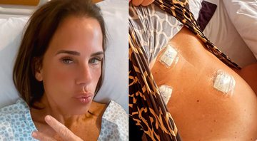 Andréa Veiga fez cirurgia para retirar a vesícula - Foto: Reprodução/ Instagram@veigaandrea