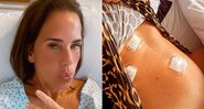 Andréa Veiga fez cirurgia para retirar a vesícula - Foto: Reprodução/ Instagram@veigaandrea