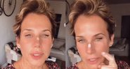 Andrea apareceu com um curativo no nariz e alertou os seguidores a usarem protetor solar - Reprodução/Instagram
