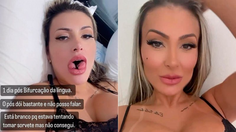 Andressa Urach mostrou língua bifurcada e falou sobre o pós-operatório - Foto: Reprodução/ @andressaurach