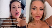 Andressa Urach mostrou língua bifurcada e falou sobre o pós-operatório - Foto: Reprodução/ Instagram@andressaurach