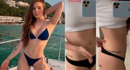 Anna Livya Padilha deu detalhes de sua Lipo Lad na web - Foto: Reprodução/ Instagram