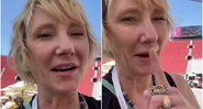 Anne Heche sofreu o grave acidente que a deixou em coma - Foto: Reprodução / Instagram