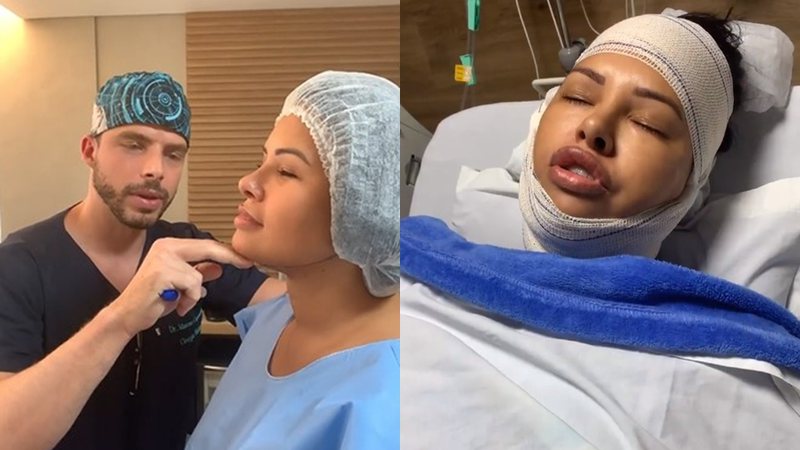 Ariadna antes e depois de suas cirurgias - Foto: Reprodução / Instagram @ariadnaarantes