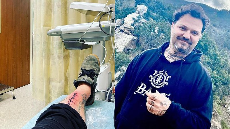 Bam Margera e sua tatuagem infeccionada - Reprodução/Instagram@bam__margera