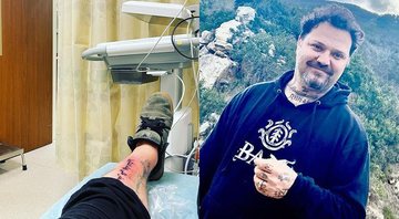 Bam Margera e sua tatuagem infeccionada - Reprodução/Instagram@bam__margera
