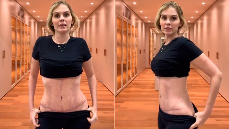 Bárbara Evans mostrou cicatriz após plásticas nos seios e barriga - Foto: Reprodução/ Instagram@barbaraevans22