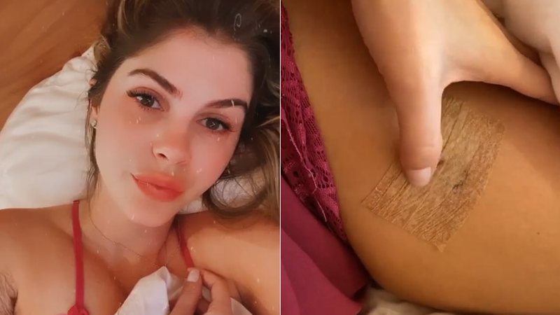 Bárbara Evans mostrou curativos na perna e debaixo do braço após remoção de pintas suspeitas - Foto: Reprodução/ Instagram
