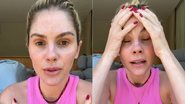 Bárbara Evans contou que está lutando contra o vício em remédio para dormir
