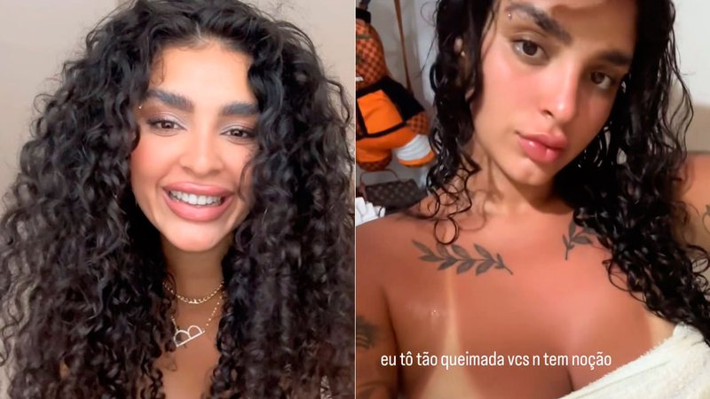 Cantora Bianca mostrou pele bem vermelha após dia de praia - Foto: Reprodução/ Instagram@biancaoficial