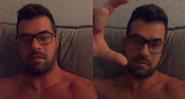 Bruno Miranda, o Borat de Amor e Sexo, recebeu alta após nova cirurgia - Foto: Reprodução / Instagram