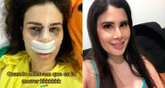 Camilla Uckers lembrou cirurgia de implante de silicone nos glúteos - Foto: Reprodução/ Instagram@camillauckers