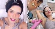 Carol Dias aplicando botox nas axilas - Reprodução/Instagram