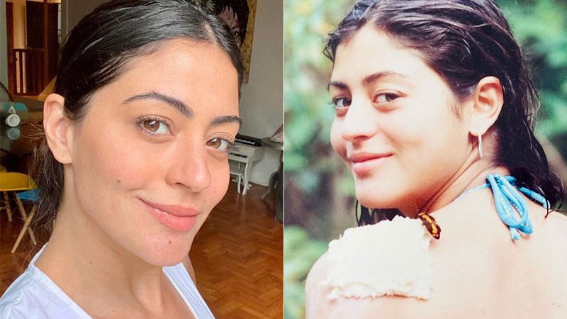 Carol Castro em foto atual, aos 36 anos, e na época do acidente, aos 16 anos - Foto: Reprodução/ Instagram