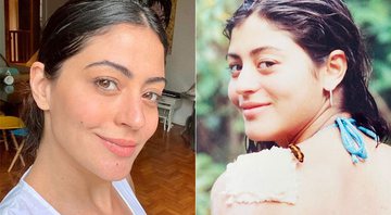 Carol Castro em foto atual, aos 36 anos, e na época do acidente, aos 16 anos - Foto: Reprodução/ Instagram