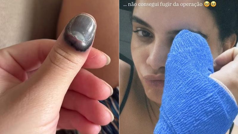 Carol Macedo passou por cirurgia após prender o dedo na porta do carro