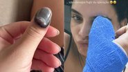 Carol Macedo passou por cirurgia após prender o dedo na porta do carro