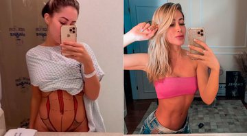 Carol Narizinho posou com a barriga de fora 30 dias após Lipo LAD - Foto: Reprodução/ Instagram@carolnarizinho