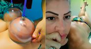 Cátia Paganote mostrou massagem e procedimento para turbinar o bumbum - Foto: Reprodução/ Instagram@catiapaganote