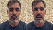 Juliano Cazarré falou sobre estado de saúde da filha
