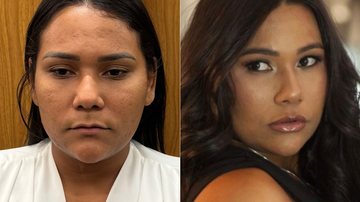 Chaiany mostrou antes e depois de tratamentos estéticos