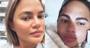 Chrissy Teigen compartilha resultado de seu transplante de sobrancelhas - Foto: Reprodução / Instagram @chrissyteigen