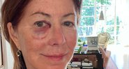 Atriz contou que teve medo de fraturas, mas garantiu estar bem - Foto: Reprodução / Twitter @danadelany