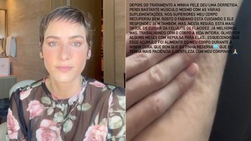 Dani Gondim falou sobre as mudanças no corpo após tratamento contra o câncer - Foto: Reprodução/ Instagram@danigondim1