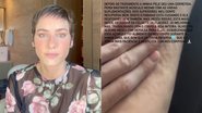 Dani Gondim falou sobre as mudanças no corpo após tratamento contra o câncer