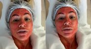 Dani Souza falou sobre intrigante tratamento de rejuvenescimento - Foto: Reprodução/ Instagram@dani_souza_