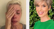 Atriz compartilhou um antes e depois de sintomas de fibromialgia - Foto: Reprodução / Instagram