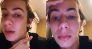 Davi contou em seus stories sobre a importância do diagnóstico precoce - Reprodução/Instagram