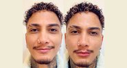 Dynho Alves mostra resultados da harmonização facial - Reprodução