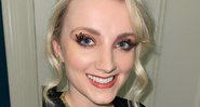 Atriz diz que foi diagnosticada quando tinha entre 11 e 12 anos - Reprodução / Instagram @evannalynch