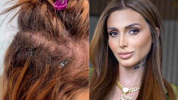 Fernanda Campos mostrou falha após problema com mega hair - Foto: Reprodução/ Instagram@feercamppos