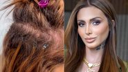 Fernanda Campos mostrou falha após problema com mega hair - Foto: Reprodução/ Instagram@feercamppos