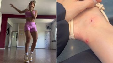 Gabi Martins mostrou bolhas no pé após aula de samba - Foto: Reprodução/ Instagram@gabimartins