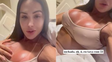 Tratando lesão, Gracyanne mostrou corpo inchado no hospital
