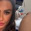 Gracyanne Barbosa mostrou punção no joelho para a retirada de líquido
