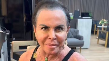 Gretchen contou que diagnóstico de alopecia mexeu com sua autoestima