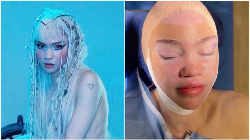 Grimes teria colocado orelhas de elfo em cirurgia plástica - Foto: Reprodução / Instagram