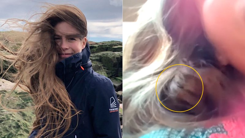 Hannah Bourne-Taylor deixou Tentilhão fazer seu cabelo de ninho por três meses - Foto: Reprodução/ Twitter@WriterHannahBT