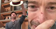 Hugh Jackman se machucou durante um ensaio para espetáculo na Broadway - Foto: Reprodução / Instagram @thehughjackman