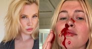 Ireland comentou que estava cuidando de duas crianças de 7 anos quando se machucou - Reprodução/Instagram