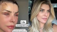 Iris Stefanelli mostrou resultado de cirurgia plástica no rosto - Foto: Reprodução/ Instagram@irisstefanelli