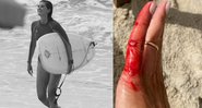 Isabela acabou se machucando enquanto treinava surf no Guarujá - Reprodução/Instagram