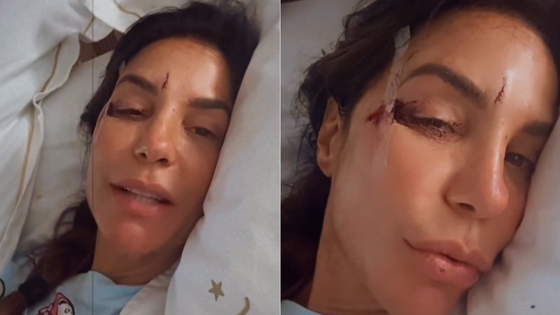Ivete Sangalo bateu o rosto após desmaiar no banheiro